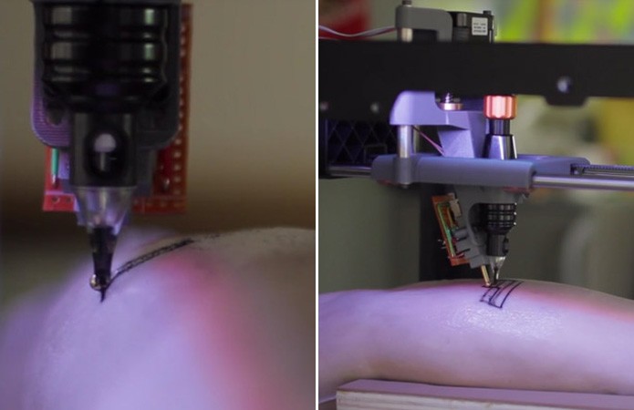 Sensores mapeiam a pele para que a impressora se adapte às mudanças de textura, rigidez e formas (Foto: Reprodução/Dezeen)